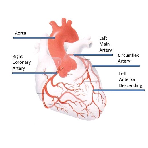 coronary-angiography-doctor